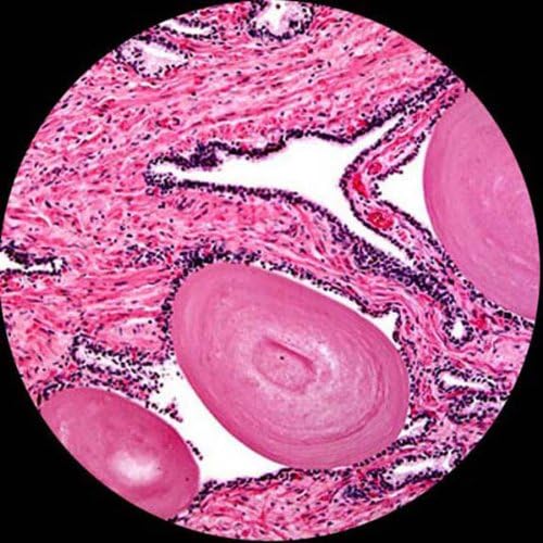 AmScope M150C-E-I 40X-1000X LED Cordless All-Metal Framework Full-Glass Optical Lens Student Biological Compound Microscope + Digital Camera USB Imager