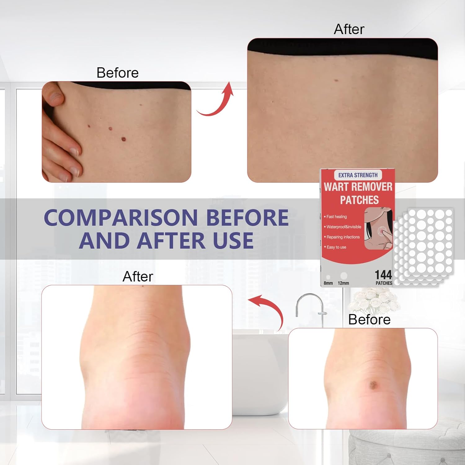 HSFIYAKJ Hydrocolloid Patches, 144 Pcs